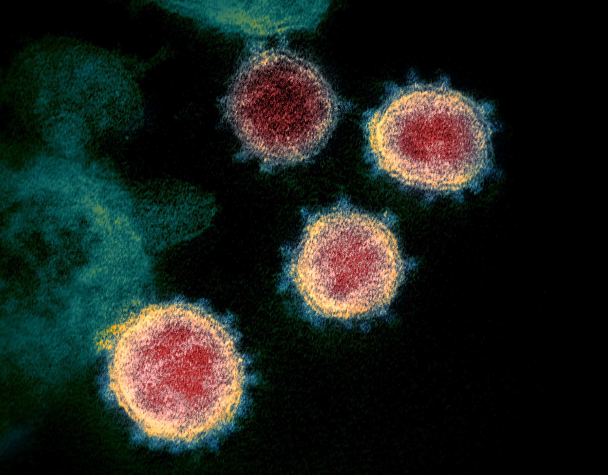 Important to trace the origin of SARS-CoV-2