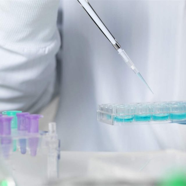 in vitro diagnostics